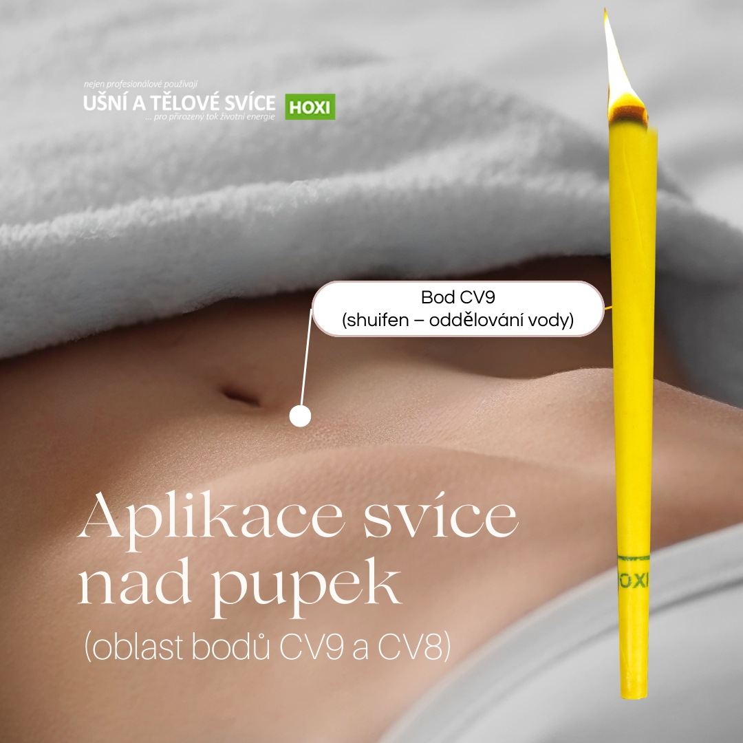 Aplikace tělové svíce HOXI nad pupek (oblast bodů CV9 a CV8)